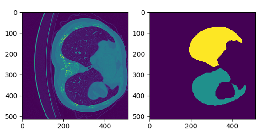 The model requires two images as inputs, a CT scan image, and a lung segmentation mask, to guide the model to focus on the lung area